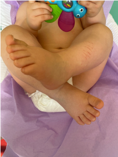 bébé croisement des jambes